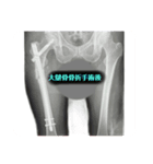 骨折会社休みます、手術入院！（個別スタンプ：2）